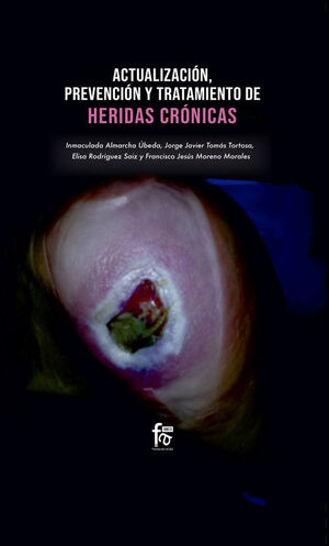 ACTUALIZACIONES, PREVENCION Y TRATAMIENTO DE HERIDAS CRONICAS